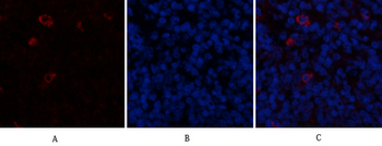 PTEN Polyclonal Antibody