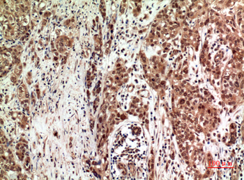 FOG-2 Polyclonal Antibody
