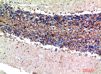 S-100 α Polyclonal Antibody