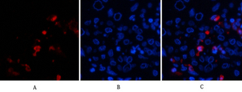 BMP-2 Polyclonal Antibody