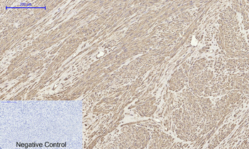 BMP-2 Polyclonal Antibody