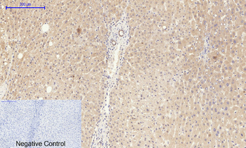 NGF Polyclonal Antibody