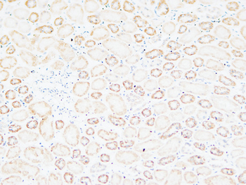 Tenascin-C Polyclonal Antibody