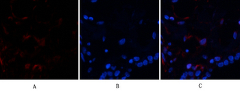 Ub Polyclonal Antibody