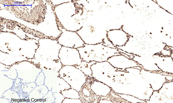 Ub Polyclonal Antibody