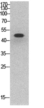 p53 Polyclonal Antibody