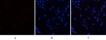 HMG-1 Polyclonal Antibody