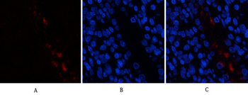 HMG-1 Polyclonal Antibody