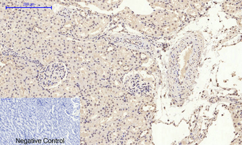 HMG-1 Polyclonal Antibody