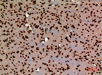 HMG-1 Polyclonal Antibody