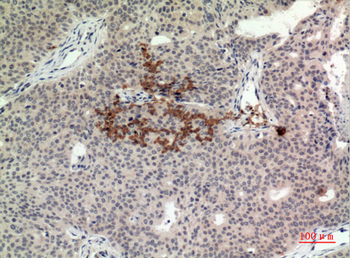 TMEM173 Polyclonal Antibody