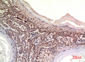 Nov Polyclonal Antibody