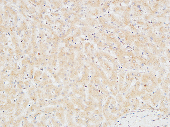 Troponin T-C Polyclonal Antibody