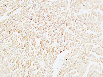 Troponin T-C Polyclonal Antibody