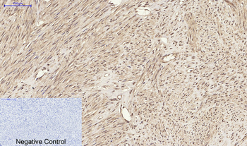 Nrf2 Polyclonal Antibody