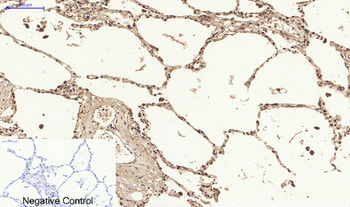 Nrf2 Polyclonal Antibody