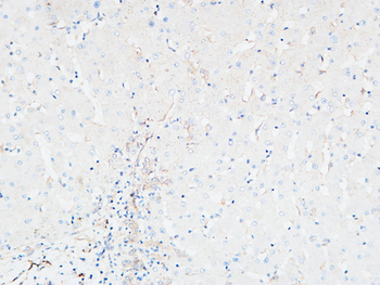 CDCP1 Polyclonal Antibody