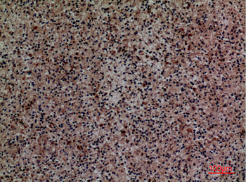 Siglec-5/14 Polyclonal Antibody