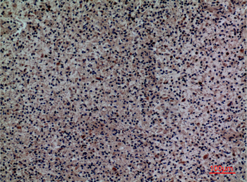 Siglec-5/14 Polyclonal Antibody