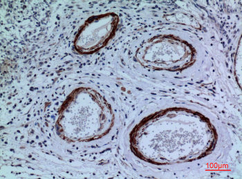 CYP11A1 Polyclonal Antibody