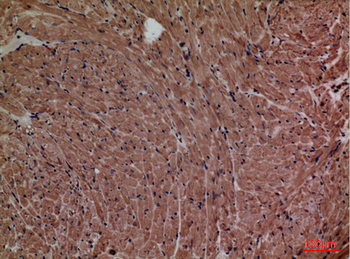 P2X3 Polyclonal Antibody