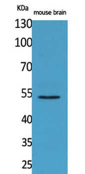 CPE Polyclonal Antibody