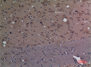 CPE Polyclonal Antibody