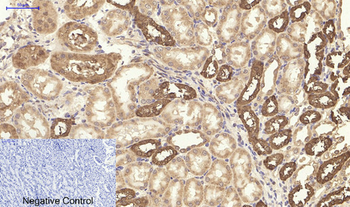 Mcl-1 Polyclonal Antibody