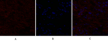 IL-8 Polyclonal Antibody