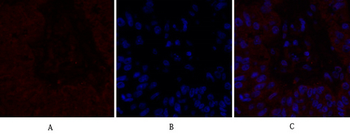 IL-8 Polyclonal Antibody