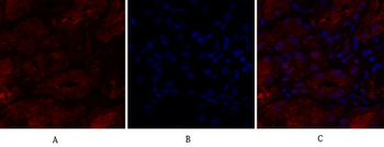 IL-8 Polyclonal Antibody