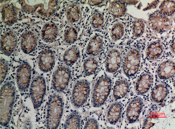 TRPV3 Polyclonal Antibody