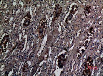 RhCG Polyclonal Antibody