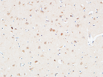 AAT Polyclonal Antibody