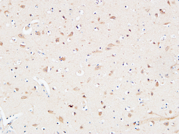 AAT Polyclonal Antibody