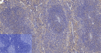 VIM Polyclonal Antibody
