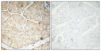 VEGF-A Polyclonal Antibody