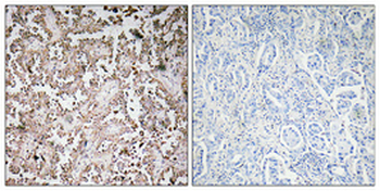 VAMP-1/2/3 Polyclonal Antibody