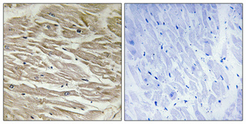 TUSC2 Polyclonal Antibody