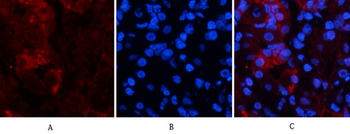 TNF-α Polyclonal Antibody