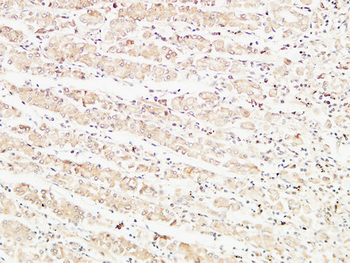 TNF-α Polyclonal Antibody