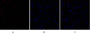 TIMP-1 Polyclonal Antibody
