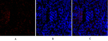 TIMP-1 Polyclonal Antibody