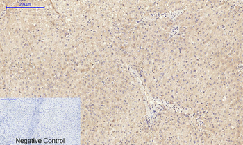 TIMP-1 Polyclonal Antibody