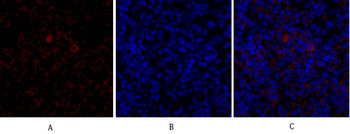 TGFβ RII Polyclonal Antibody
