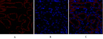 TGFβ RII Polyclonal Antibody