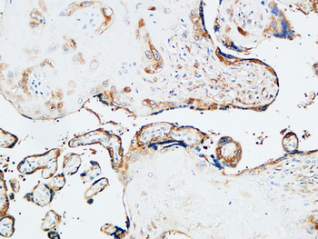 TGase2 Polyclonal Antibody
