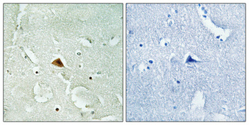 Rad23B Polyclonal Antibody