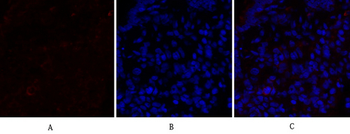 PPAR-α Polyclonal Antibody