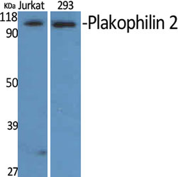 Plakophilin 2 Polyclonal Antibody